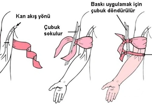 Konu görseli